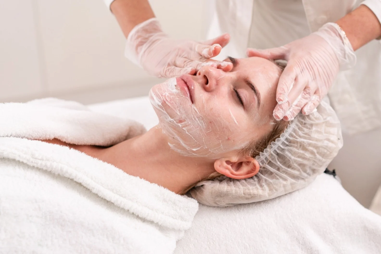 Acne Peel Treatment in Atlanta, GA at Gizel Atlanta