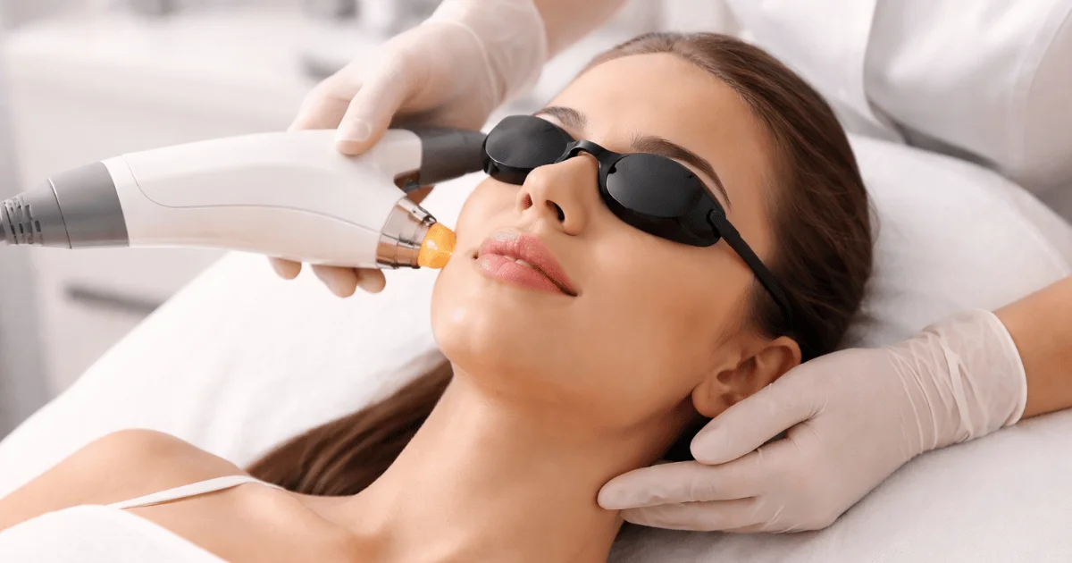 Laser skin treatment for acne, pigmentation, and skin rejuvenation